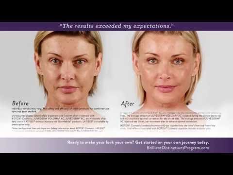 Botox, Juvederm & Voluma Before and After Photos
